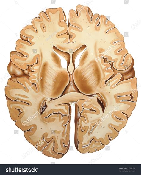 Cross Sectional Anatomy Of Brain