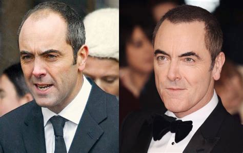 James Nesbitt Hair Transplant Westminster Medical Group