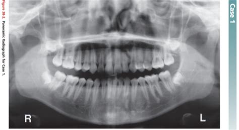 Chapter Patient Cases Radiographic Analysis Flashcards Quizlet