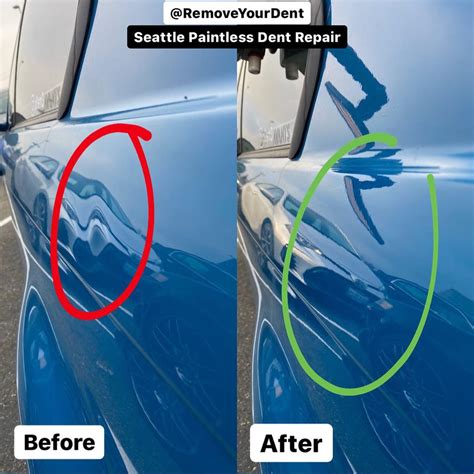 Seattle Paintless Dent Repair Services Remove Your Dent