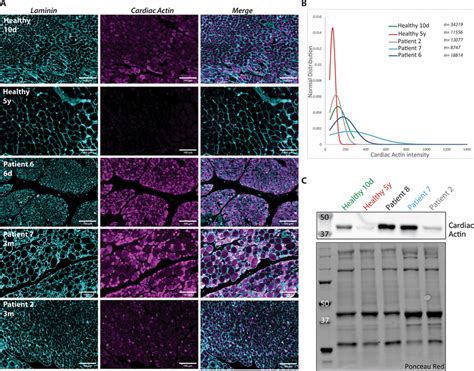 Cardiac α Actin Immunofluorescence A Cardiac α Actin Signals