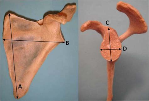 Photograph Of A Left Scapula Anterior View A Major Longitudinal Axis Download Scientific