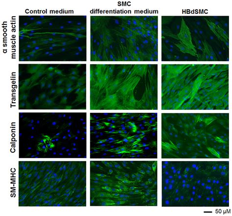 Expression Of Contractile SMC Specific Proteins Analyzed By