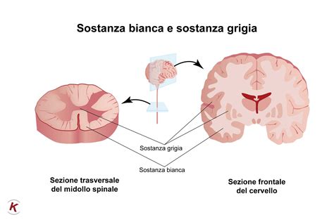 MORTE ENCEFALICA