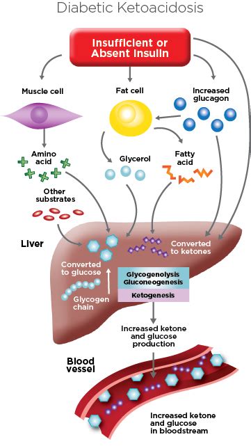 Diabetic Ketoacidosis - EKF Diagnostics - Stanbio