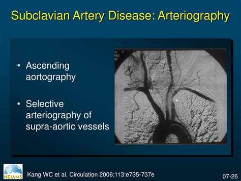 Ppt Subclavian Artery Disease Simulation Training Curriculum Powerpoint Presentation Id 3552902