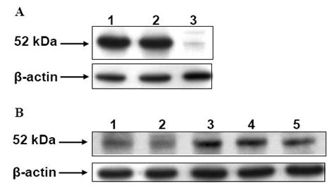 Expression And Initial Characterization Of Human Aldh3b1 Pmc