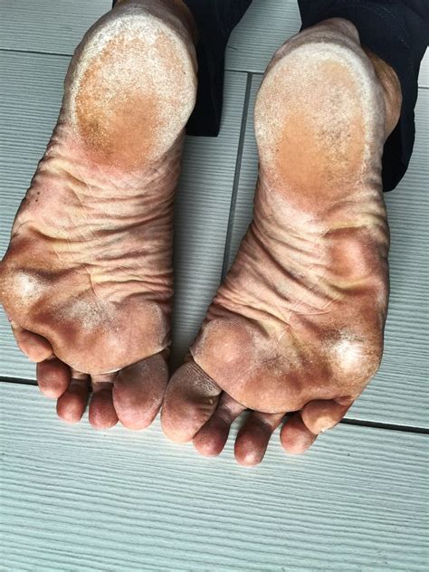 Black Male Feet Soles Telegraph