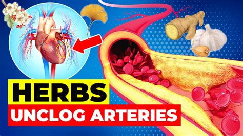 Top 10 Herbs To Unclog Your Arteries And Prevent Heart Attack Naturally