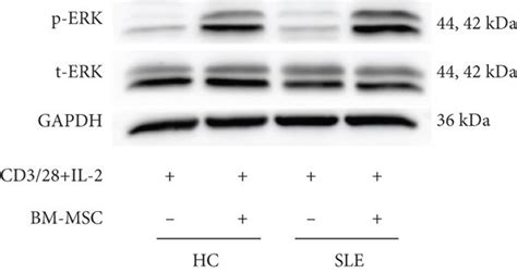 Mekerk Pathway Of Sle Pbmc Is Activated And Dnmt1 Increases After The