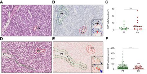 Hepatocytes Undergo Punctuated Expansion Dynamics From A Periportal