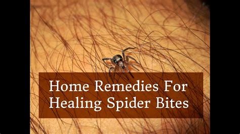 Home Remedies For Healing Spider Bites Youtube