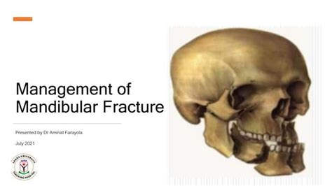 Management Of Mandibular Fractures Treatment Options And Complications Ppt