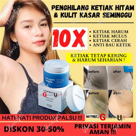 Jual CREAM PEMUTIH KETIAK ORI EVER WHITE AXILLARY CREAM 15GR ORIGINAL