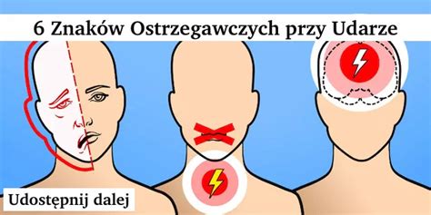 6 znaków ostrzegawczych przy nadchodzącym udarze jak je poznać