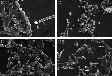 Selection And Characterization Of Bacillus Thuringiensis Strains From