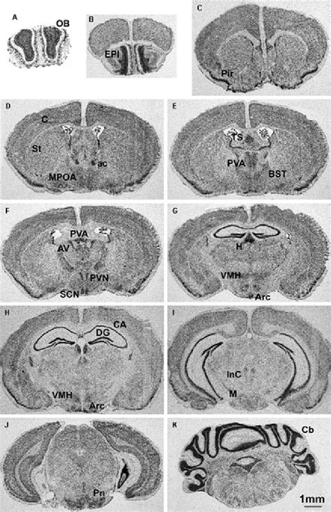 Expression Of Jarid C In Adult Mouse Brain Using In Situ Hybridization