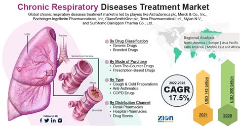 Chronic Respiratory Diseases Treatment Market Insight, Size, Share 2028