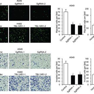 TBL1XR1 Promotes NSCLC Cell Migration And Invasion A Migration Assay