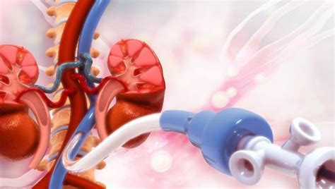 Vascular Surgery Al Tadawi Specialty Hospital