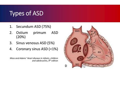 Atrial septal defect