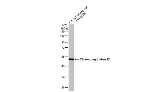 Chikungunya Virus E1抗体 Hl2069 Gtx637973 Genetex中文官方网站