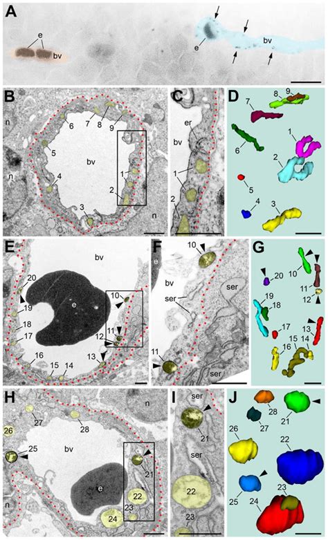 Alteration Of Slp2 Like Immunolabeling In Mitochondria Signifies Early