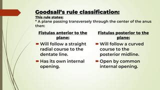 Perianal fistula (fistula in ano) | PPT