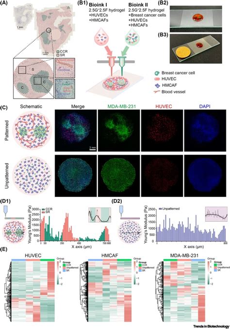 Bioprinted Spatially Defined Breast Tumor Microenvironment Models Of