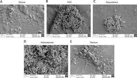 Scanning electron microscopy reveals biofilm formation of... | Download ...