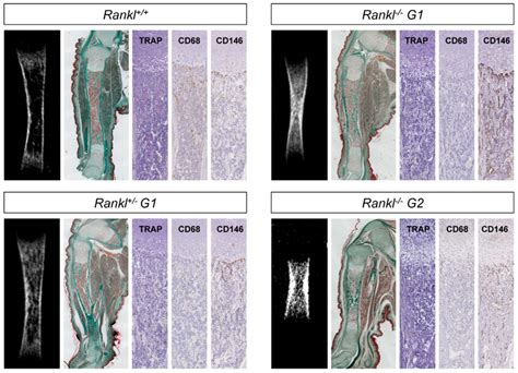 Microct Mct And Histological Comparative Analysis Of The Appendicular