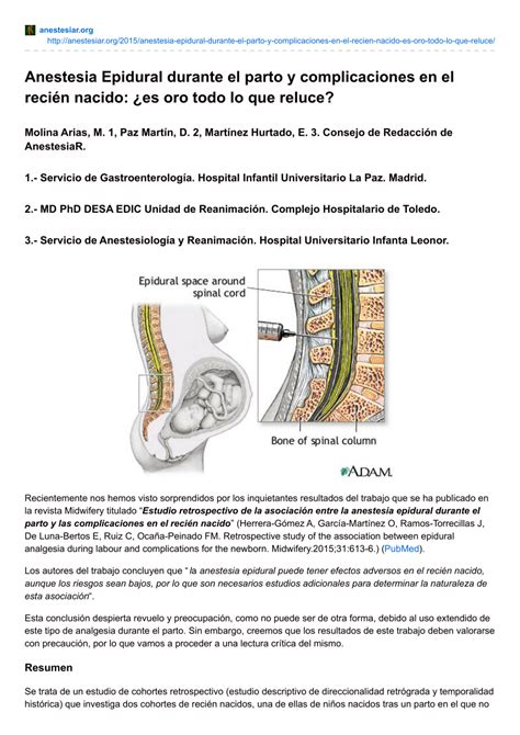 PDF Anestesia Epidural durante el parto y complicaciones en el recién