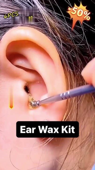 Product Link In The Comments Ear Wax Cleaning Kit Youtube