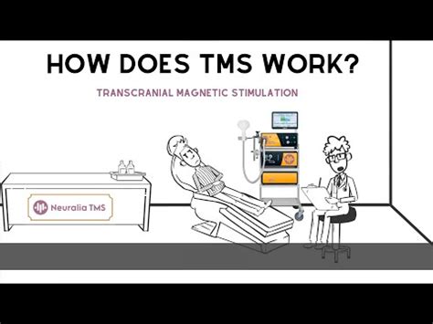 Tms Clinic Perth Transcranial Magnetic Stimulation Neuralia Tms