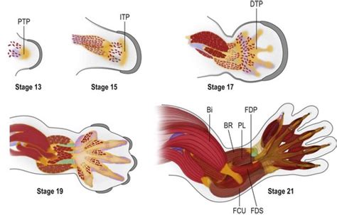 Congenital Hand I Embryology Classification And Principles Plastic