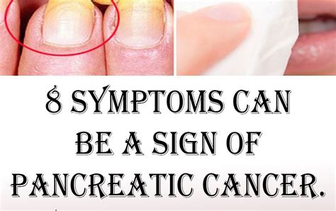 8 Symptoms That Can Be A Sign Of Pancreatic Cancer Youd Better Not