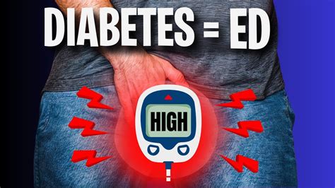 Erectile Dysfunction And Diabetes Heres What You Need To Know Youtube