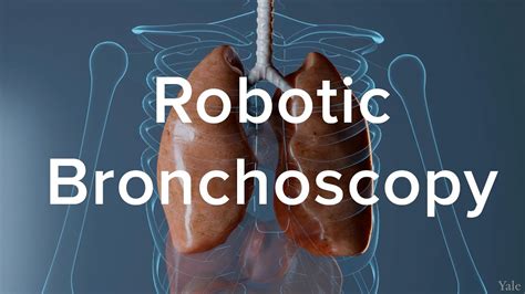 How Robotic Bronchoscopy Helps Diagnose Lung Cancer > News > Yale Medicine