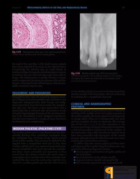 Neville Oral And Maxillofacial Pathology E Pdf