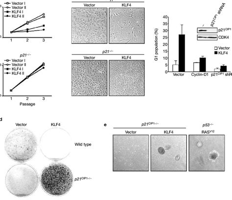 P21cip1 Loss Converts Klf4 From Cell Cycle Inhibitor Into Oncoprotein