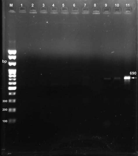 Agarose Gel Electrophoresis Pcr Products Of The Its I 58s And Its