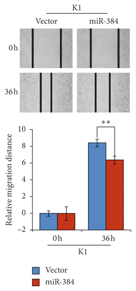 Overexpression Of Mir Inhibited The Progression Of Ptc Cells A