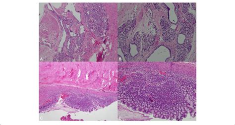 Histological Examination Of The Resected Specimen Histological