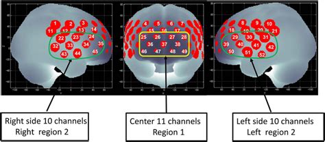 Channel Positions On The Brain Surface Right Region Consists Of The