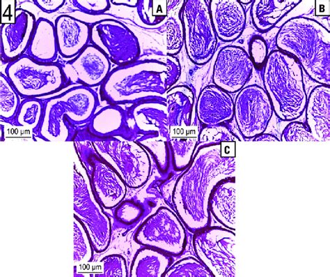 A Photomicrograph Of A Section From A Rat Epididymis Of The A