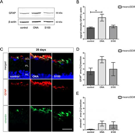 Macroglia In The Retina At Days A The Gfap Protein Level Was