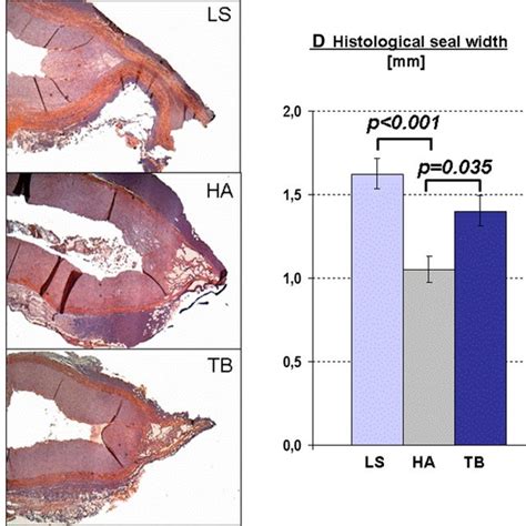 Ac Exemplary Slides Of Arterial Seals Hematoxylin And Eosin Stain