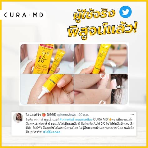 Cura Md Prebiotic Anti Acne Clear Gel Thaimegastore