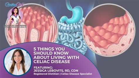 5 Things You Should Know About Living With Celiac Disease Gastro Girl