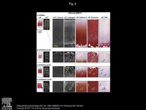 3d Histopathological Grading Of Osteochondral Tissue Using Contrast